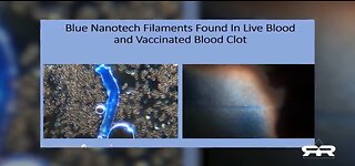 NANOTECHNOLOGY FOUND IN BOTH VAXXED AND UN-VAXXED