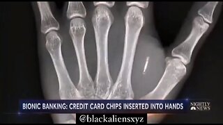 NO MORE CASH ! Soon All Will Be Microchipped