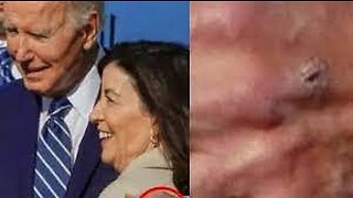 Photo’s Appear To Show IV Punctures On Biden’s Hand & Not For The First Time