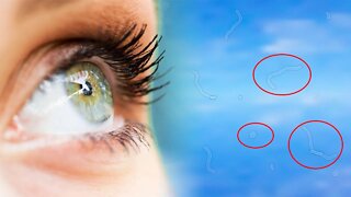 What are Eye Floaters and How Can it Affect Your Vision