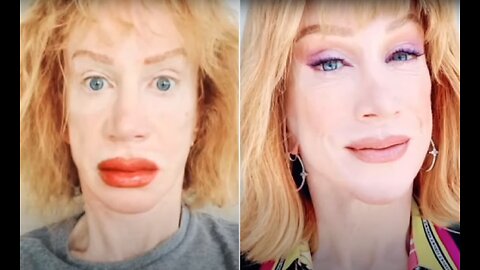 Kathy Griffin Gets Her Lips Tattooed, Friends Are Shocked by Her 'Swollen' Appearance