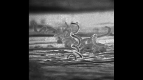 U.S. Sees Record Syphilis Cases - CDC Blames Funding Cuts