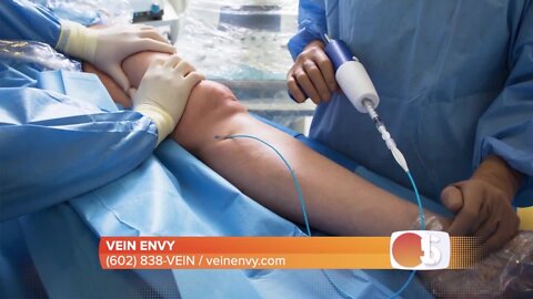 EEK!! Are your legs crawling with spider or varicose veins? Discover the Vein Envy difference