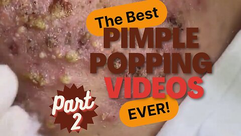 The BEST pimple POPPING videos EVER (p2)
