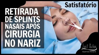 Retirada do Splint Nasal Cateter Aerador Satisfatório #2 - Just Relax | Apenas Relaxe