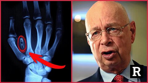 Hang on! Klaus Schwab is getting AWAY with this？Get paid $2000 mth for MOB implant