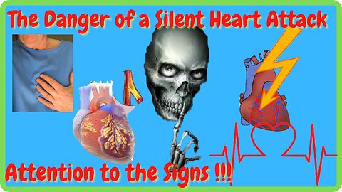 The Danger of Silent Infarction - Pay attention to the signs!!!!