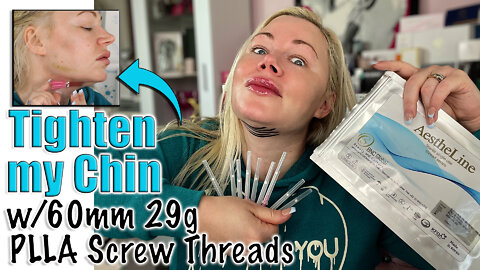 Tighten My Chin with 60mm 29g PLLA Screw Threads from Acecosm.com | Code Jessica10 Saves you Money!