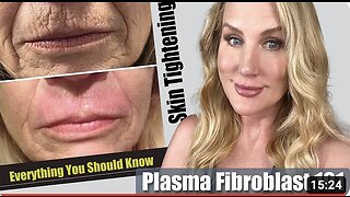 Plasma Fibroblast // Everything You Need to Know