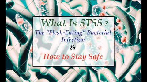 What Is STSS The “Flesh-Eating” Bacterial Infection & How to Stay Safe