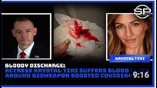 Bloody Discharge: Actress Krystal Tini Suffers Blood Clots Around Bioweapon Boosted Covidians