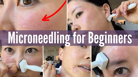 Microneedling for Beginners | Koko Face Yoga