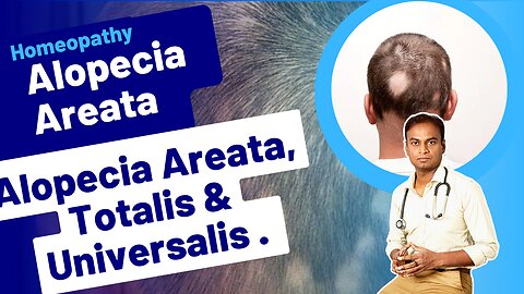 Alopecia Areata Homeopathic Treatment. Dr. Bharadwaz | Homeopathy, Medicine & Surgery