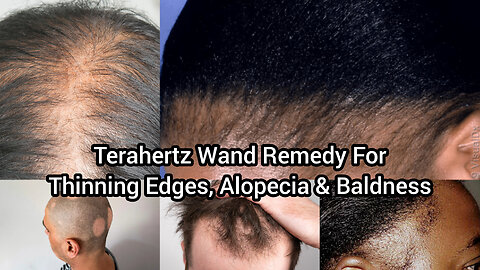 Terahertz Wand Remedy For Thinning Edges, Alopecia & Baldness