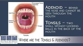 Ear, Nose and Throat Consultants