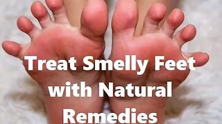 Treat Smelly Feet Naturally
