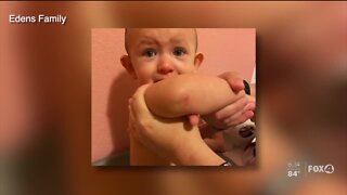 Mom says sanitizing chemicals lead to burn on child