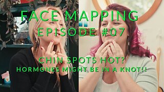 Face Mapping EP 07 - Chin Spots Hot? Hormones Might Be In a Knot!!