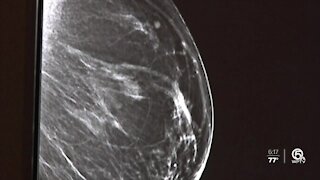 Don't wait to get annual mammogram, breast cancer survivor says