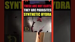 They Aren't 'Blood Clots' They Are Synthetic Parasitic Hydra Growths