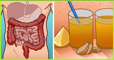 How I Got Rid Of All My Digestive Problems For Good