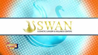 Swan Cosmetic Surgery & Wellness Centers: Thread Lift