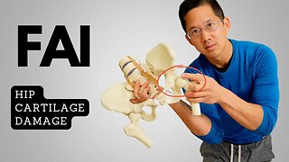 How to Save Your Hip Cartilage with Femoroacetabular Impingement (FAI)
