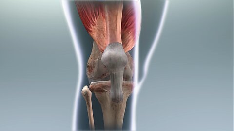 Torn meniscus part 3 knee anatomy - human body anatomy