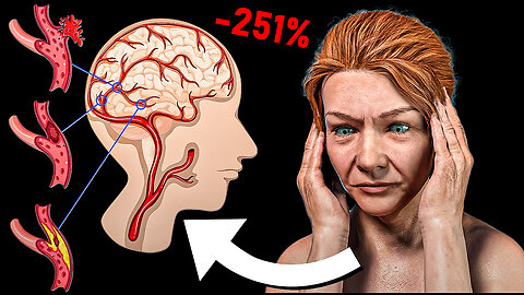 Enemies of the Brain! These 10 Foods are Destroying Your Brain