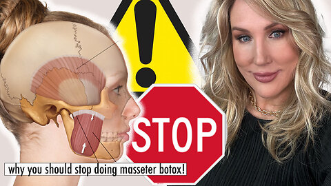 STOP Doing Masseter Botox! Here's Why!