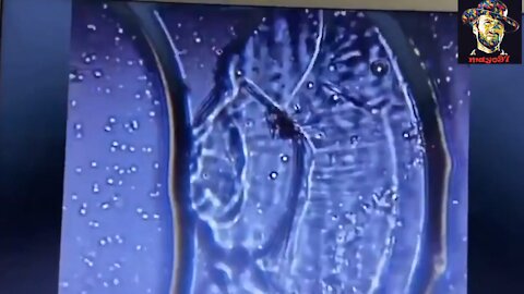 ファイザーワクチン内の謎の生物動画😱😱😱