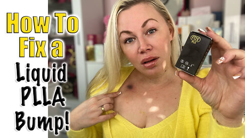 How to Fix A Liquid PLLA Bump at Home !| Code Jessica10 saves you Money