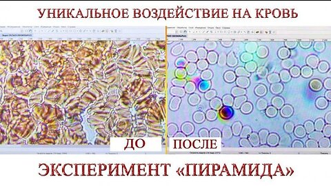 Уникальное воздействие на кровь. Эксперимент ПИРАМИДА