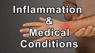 Dr. Jyothi Rao Discusses Why Inflammation Is Crucial As It Plays a Role in Numerous Medical