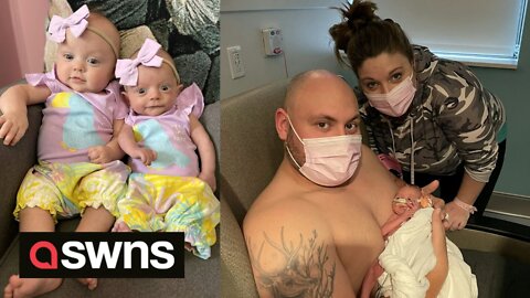 Twin born almost THREE times smaller than her sister defies odds to survive