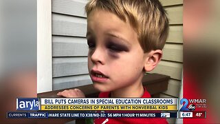 Lawmaker wants cameras in special education classrooms following reports of unexplained injuries