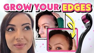 HOW TO GROW YOUR EDGES BACK FAST NATURALLY AND HAIR LINE + SPECIAL GIVEAWAY!