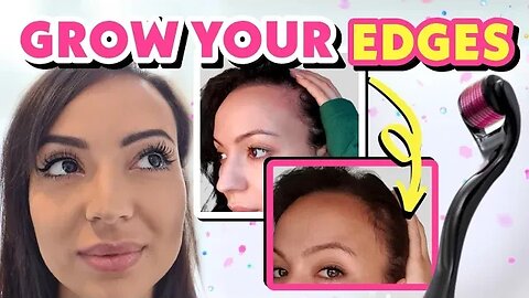 HOW TO GROW YOUR EDGES BACK FAST NATURALLY AND HAIR LINE + SPECIAL GIVEAWAY!