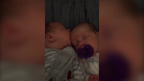 "A Baby Girl Chews and Sucks on Her Twin Sister's Head"