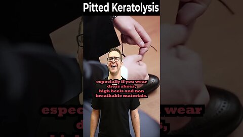 How To Get Rid of Pitted Keratolysis ONCE & FOR ALL!