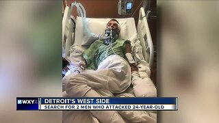 Detroit police searching for 2 suspects who attacked 24-year-old man