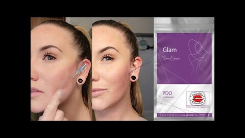 Lower Facial Double Hook Threads | Glam Thread Lift