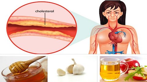 Here is The Best Medicine Against High Blood Pressure and Cholesterol