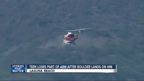 Teen loses part of arm after boulder lands on it in Laguna Beach