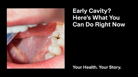 Early Cavity? Here’s What You Can Do Right Now