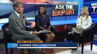 Ask the Expert: Treating summer skin
