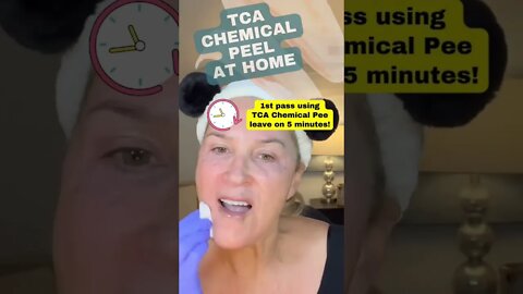 Chemical Peel At Home: WARNING - Results MAY BE UNcomfortable (TYPO: PEEL not PEE 😂)