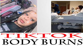 TikTok Challenge Preteen Body Burned