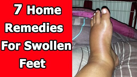 7 Home Remedies For Swollen Feet That Work
