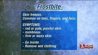 Doctor discusses protecting yourself from frostbite, hypothermia